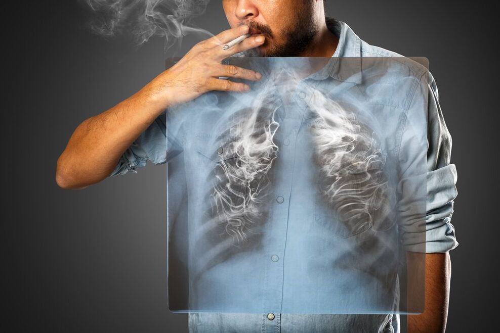 Rauchen hat schädliche Auswirkungen auf den menschlichen Körper